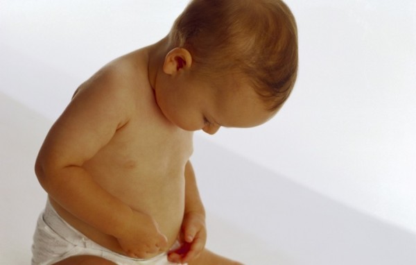 Пупочная грыжа у новорожденных: симптомы