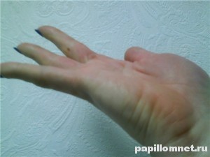 Фото родинки на указательном пальце руки