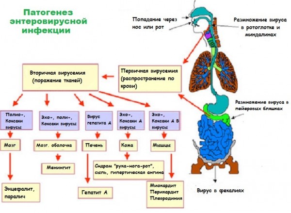 Схема воздействия энтеровирусов на организм человека