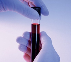 Сроки анализов крови