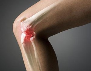 Упражнения при артрозе коленного сустава