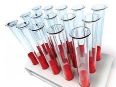 Виды лабораторных анализов крови