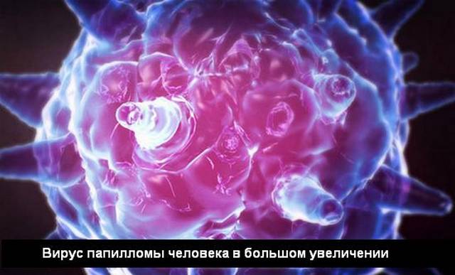 фото вируса папилломы человека
