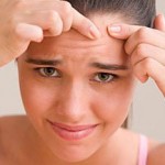 вылечить прыщи народными средствами