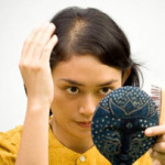 Выпадение волос: причины и лечение