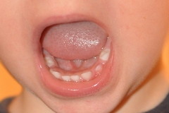 Как растут зубы у детей