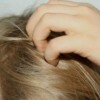 Зуд головы и выпадение волос: причины и лечение